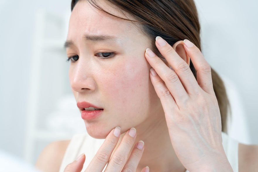 Sensitive Skin: Real vs Overdiagnosed