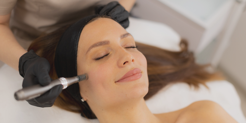 Why Is Microneedling Still One of the Most Requested Aesthetic Treatments in 2026?