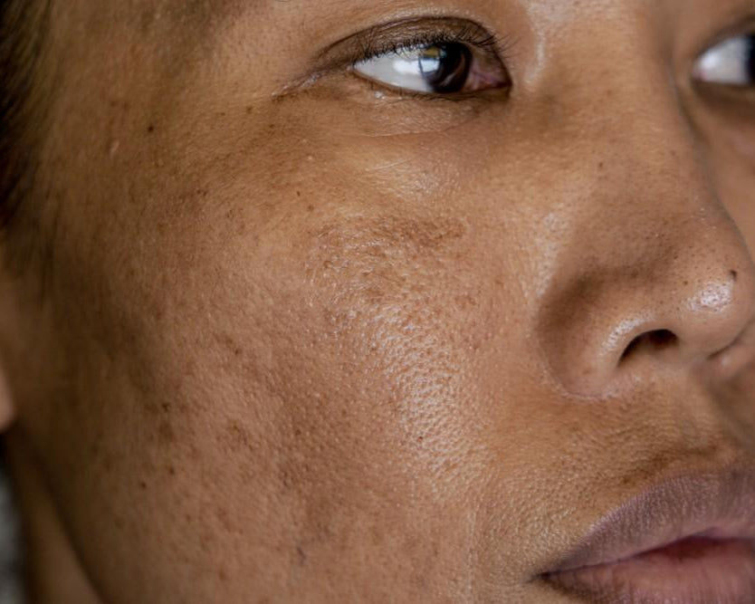 Pigment Correction Specialist: All Skin Types.