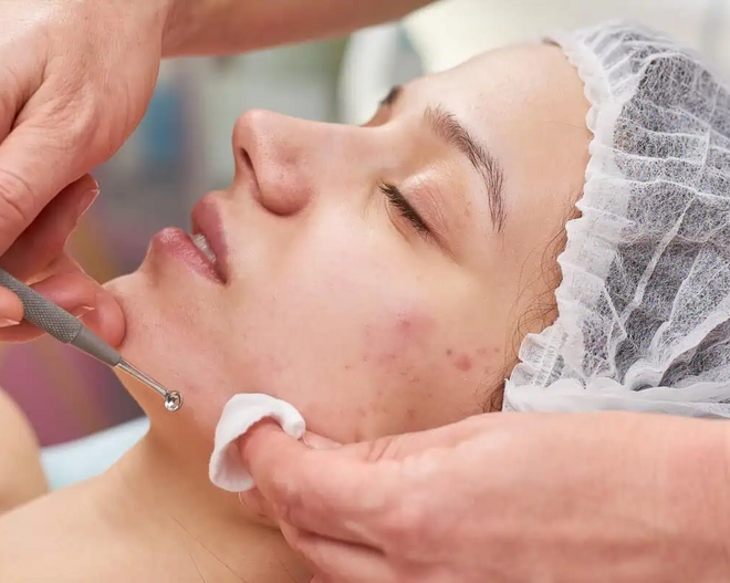 Acne Skincare Specialist