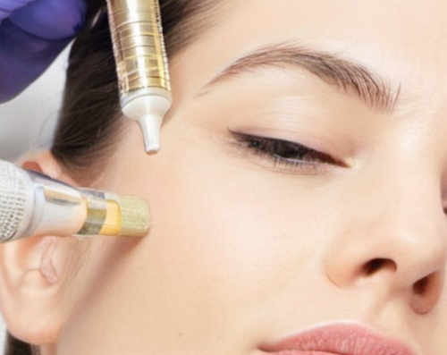 Micro needling, Nano needling and Needle Free Using Mesotherapy Online Course - Coming Soon!