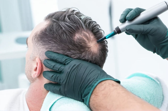 NEW! The Art and Science of Hair Restoration Modalities: Needle Free, Micro Needling and Injections Online Course