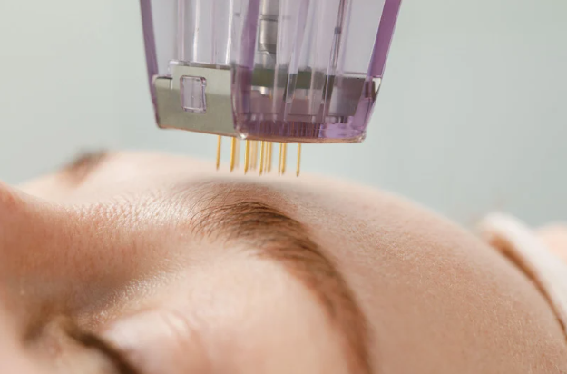 Microchanneling with RF Needle & Needle-Free Systems – Online Course – $195