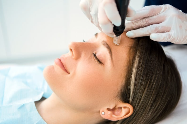 Micro Needling & Nano Needling with Needle-Free Mesotherapy – $195