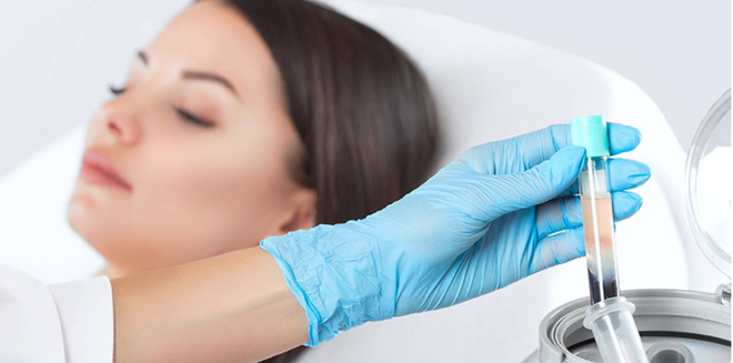 Micro Needling with PRP for Hair Restoration and Facial Rejuvenation Treatment Online